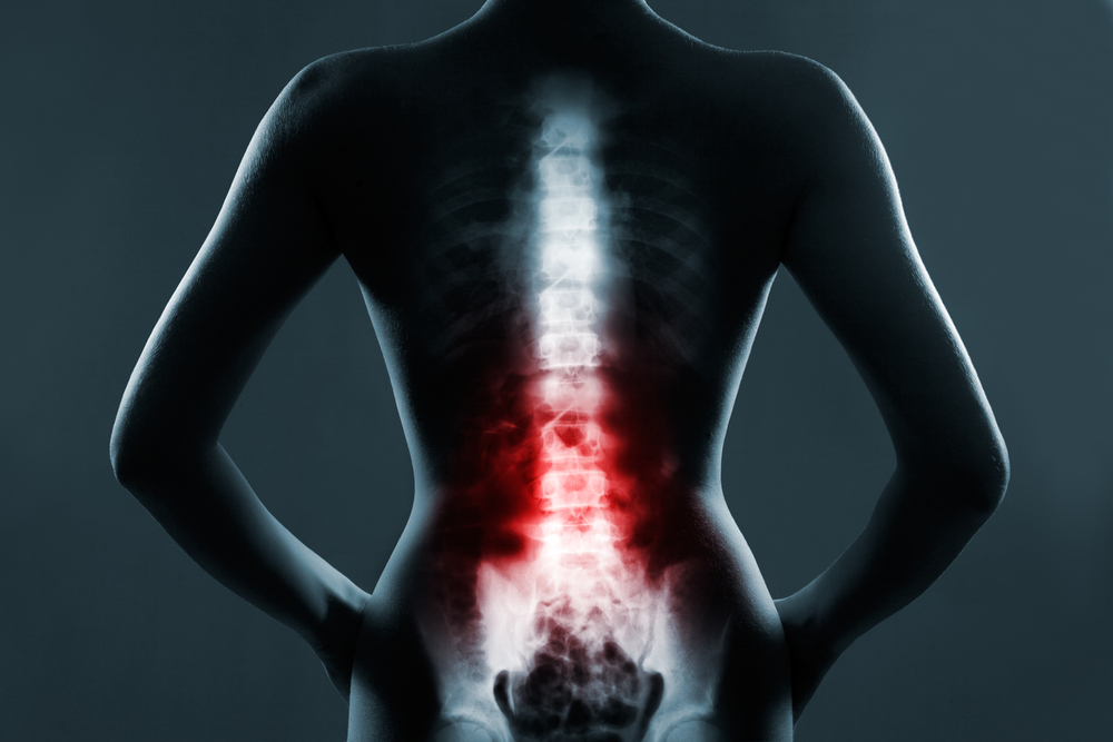 Radiology imaging of spine