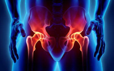 Sacroiliac (SI) Joint Dysfunction | Causes and Risk Factors