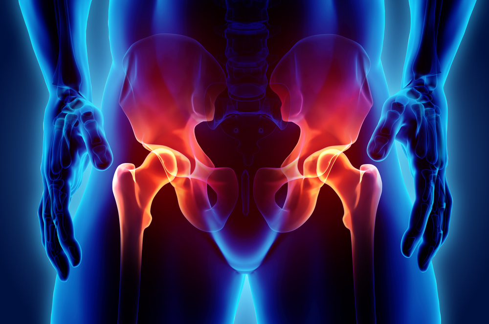 Sacroiliac (SI) Joint Dysfunction | Causes and Risk Factors